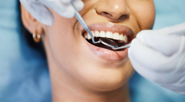 Best Lost Filling or Crown Replacement in Homewood, IL
